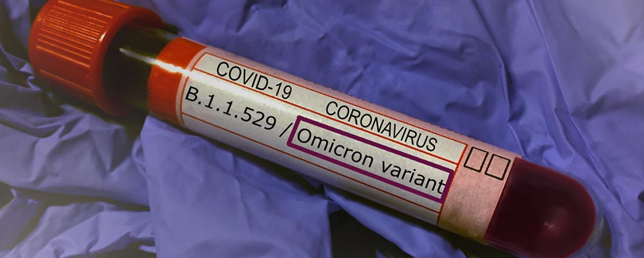 Aumentan fallecimientos y hospitalizaciones por COVID-19, casos continúan a la baja