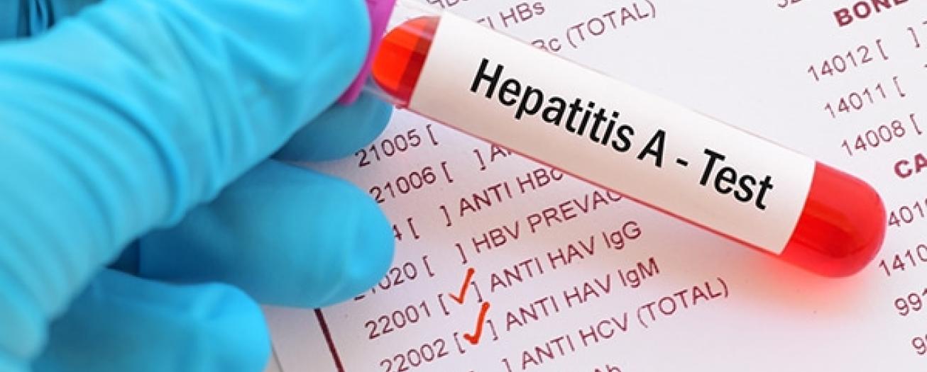 País reporta 14 casos de hepatitis A 