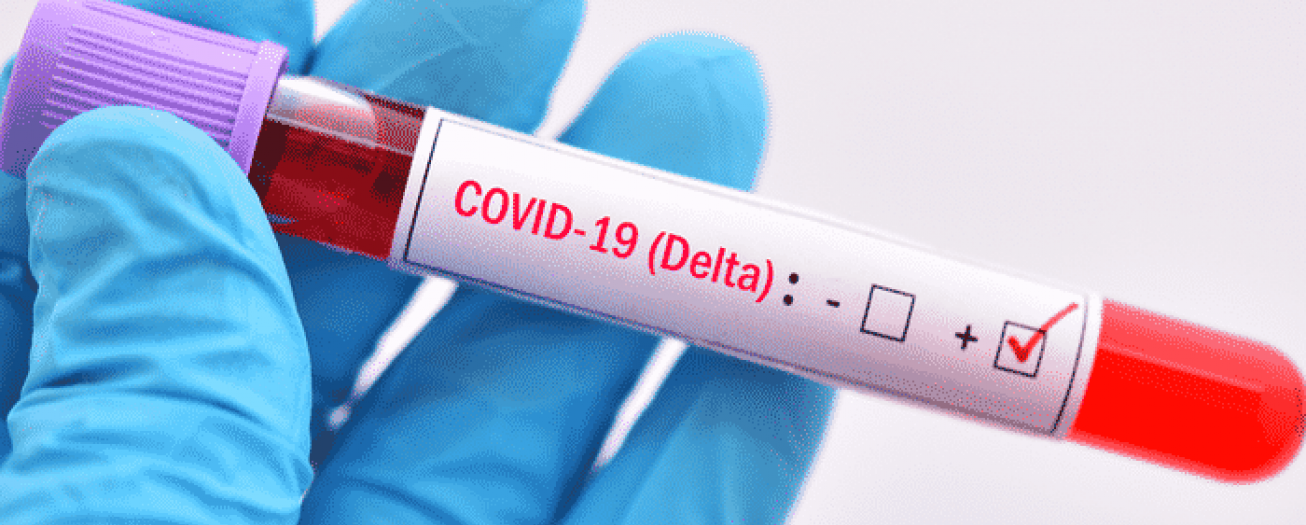 Ante aumento acelerado en el contagio del coronavirus se pide a la población mantener medidas sanitarias