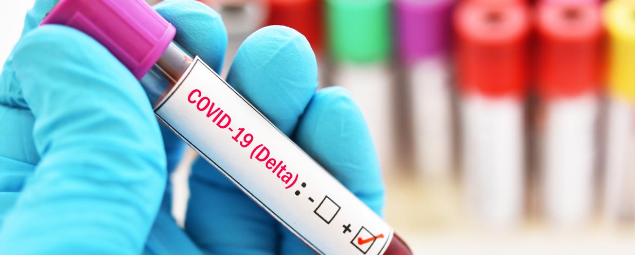 Grecia registra el aumento más significativo de casos por Covid-19 de las últimas seis semanas