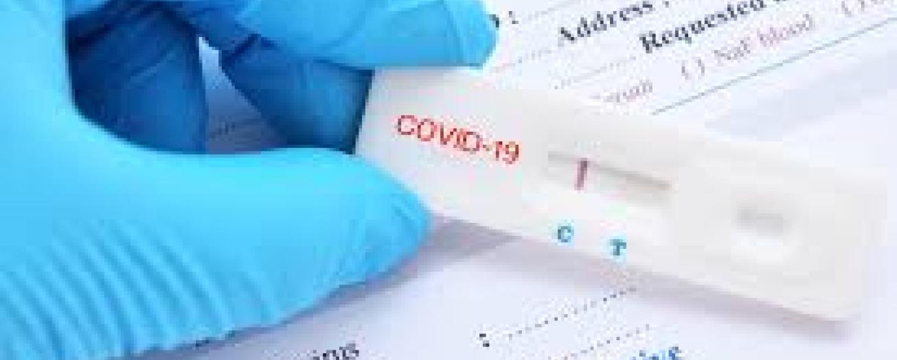 Prueba COVID-19 negativa será requisito de ingreso para personas procedentes de China, Hong Kong, Taiwán, Macao 