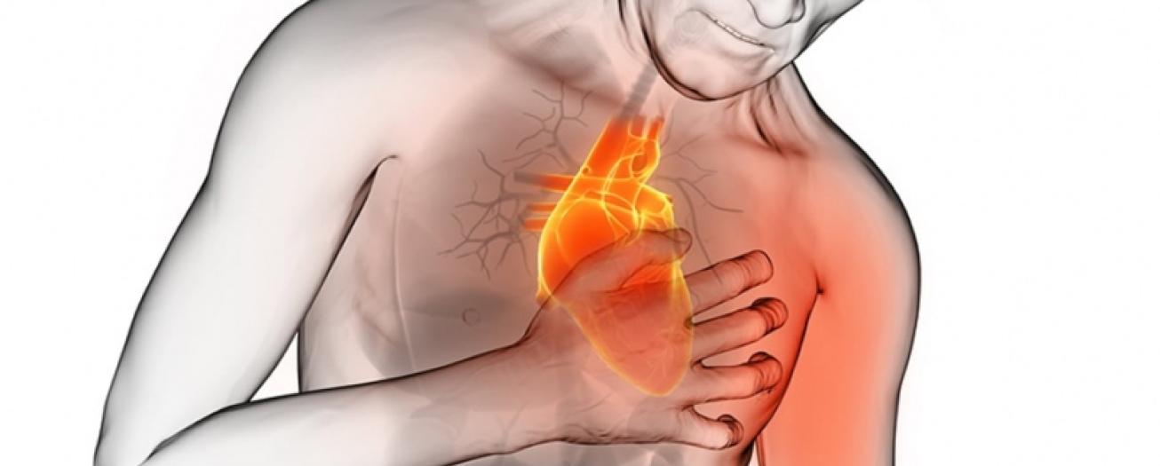Fallecimientos por infarto agudo de miocardio, aumentaron en un 11% durante el año 2022
