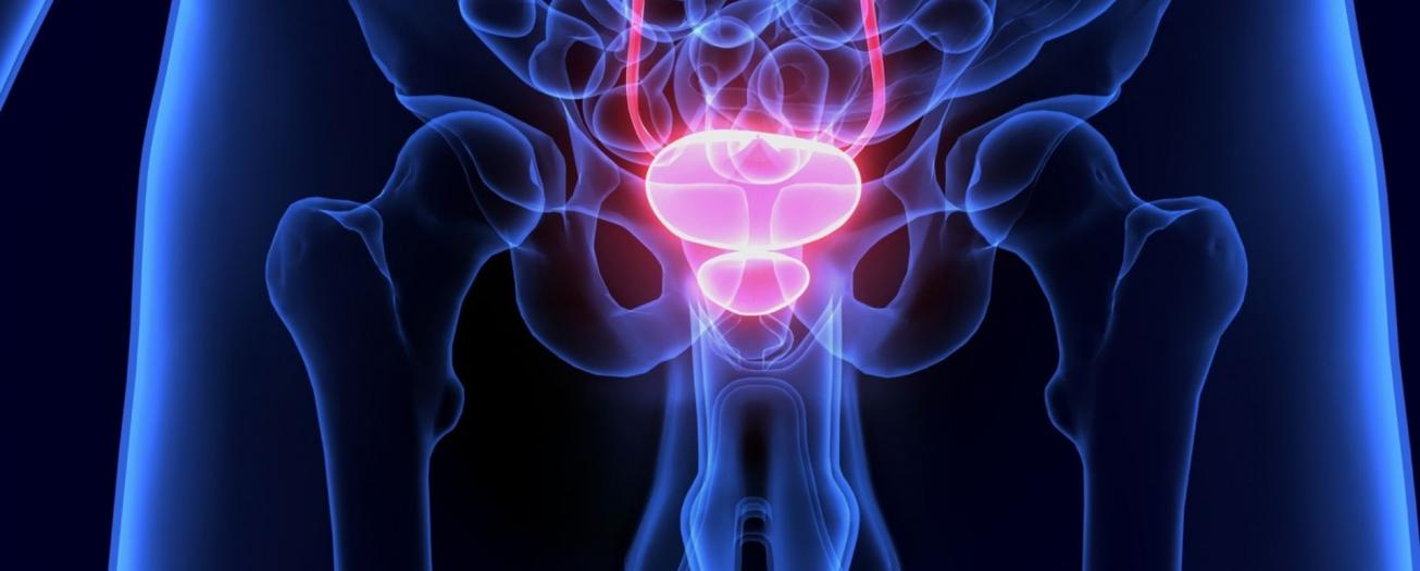 Salud hace llamado de prevención a población masculina: cáncer de próstata es el segundo más mortal 